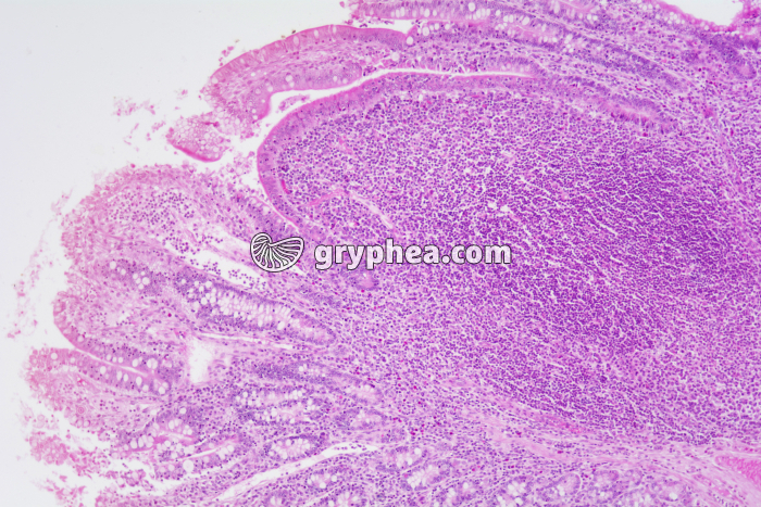 Plaque de Peyer x25 - gryphea.org